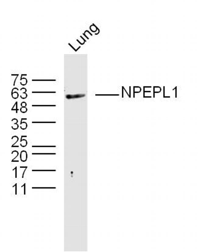 NPEPL1 Antibody in Western Blot (WB)