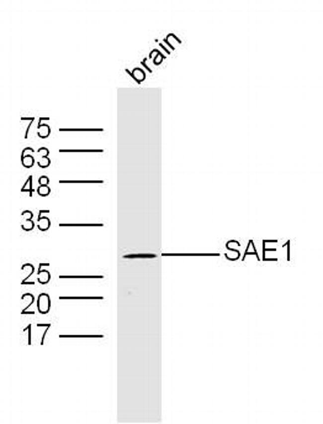 SAE1 Antibody in Western Blot (WB)