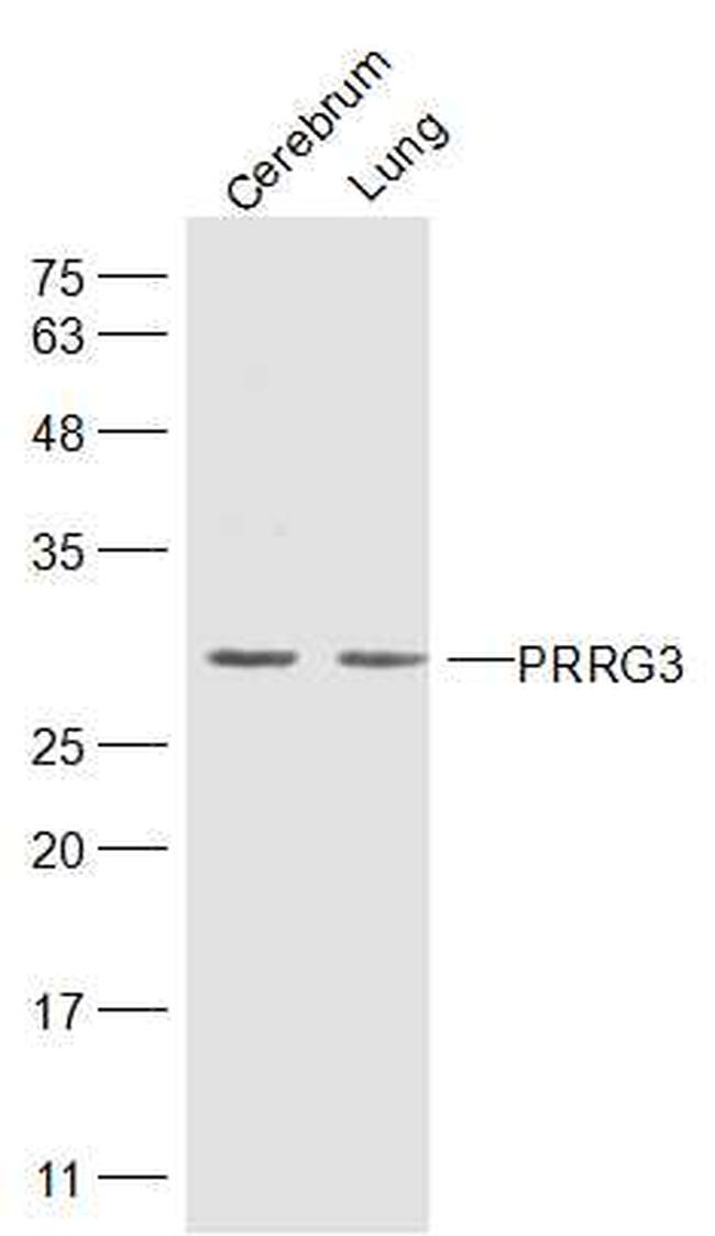 PRRG3 Antibody in Western Blot (WB)