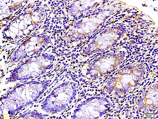 WNK3 protein Antibody in Immunohistochemistry (Paraffin) (IHC (P))
