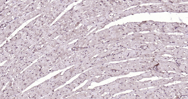 PSMD14 Antibody in Immunohistochemistry (Paraffin) (IHC (P))