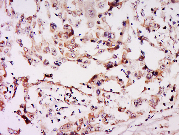 NSUN6 Antibody in Immunohistochemistry (Paraffin) (IHC (P))
