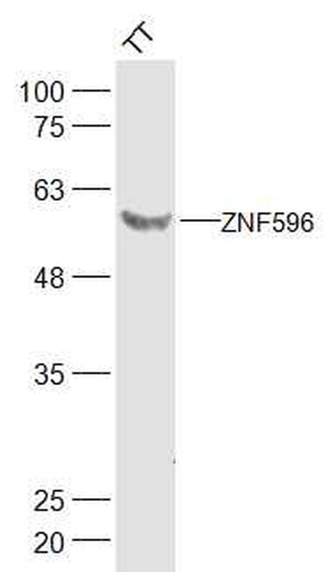 ZNF596 Antibody in Western Blot (WB)