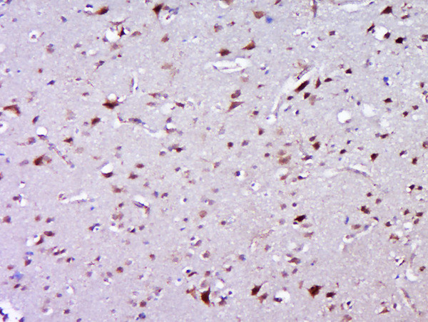 ZNF502 Antibody in Immunohistochemistry (Paraffin) (IHC (P))