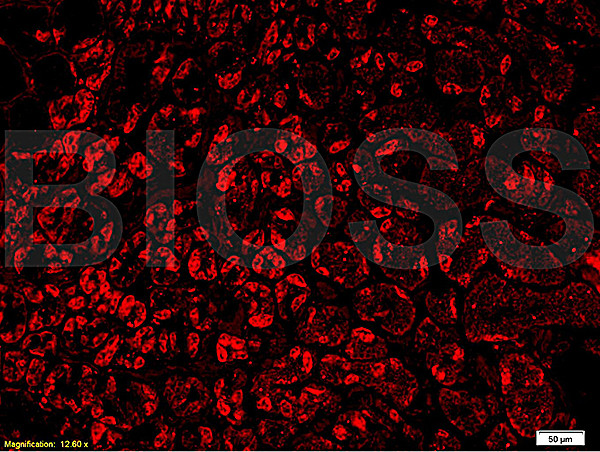 VPS18 Antibody in Immunohistochemistry (Paraffin) (IHC (P))