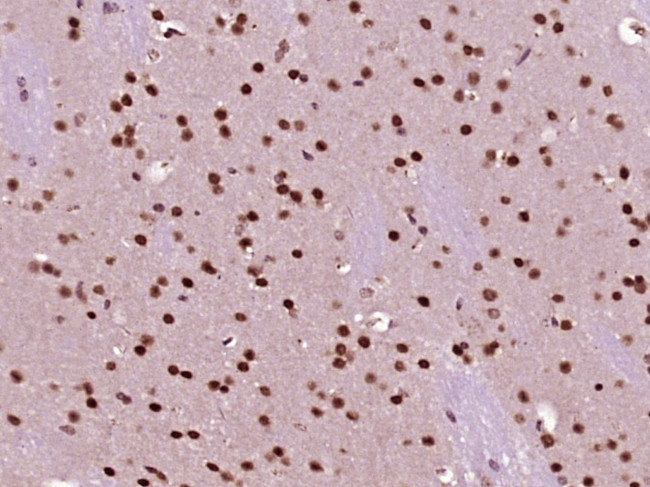 NUP43 Antibody in Immunohistochemistry (Paraffin) (IHC (P))