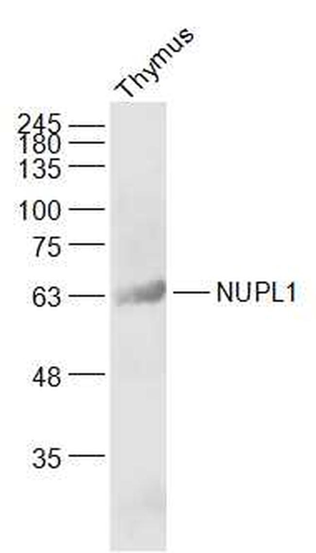 NUPL1 Antibody in Western Blot (WB)