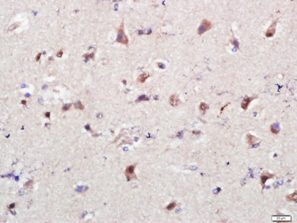 PSMG1 Antibody in Immunohistochemistry (Paraffin) (IHC (P))