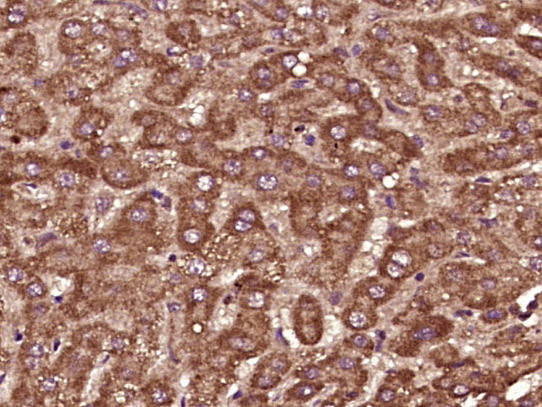 PTPD1 Antibody in Immunohistochemistry (Paraffin) (IHC (P))