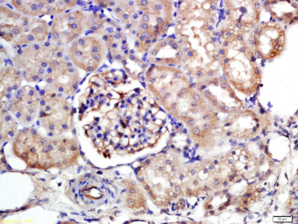 NTCP/SLC10A1 Antibody in Immunohistochemistry (Paraffin) (IHC (P))