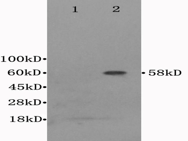 IL2 Receptor beta Antibody in Western Blot (WB)