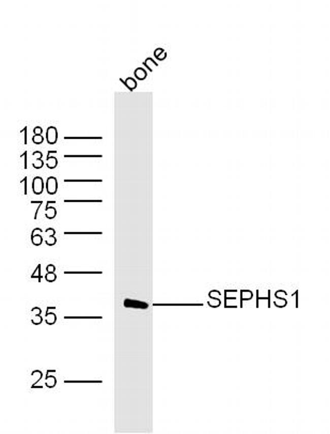 SEPHS1 Antibody in Western Blot (WB)