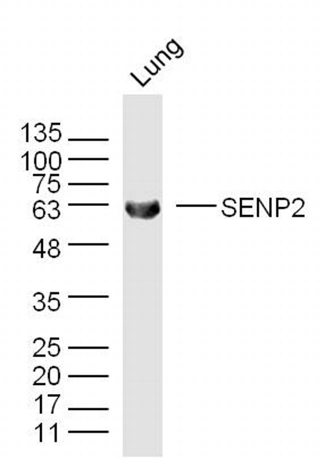 SENP2 Antibody in Western Blot (WB)