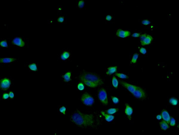 LAMP-1 Antibody in Immunocytochemistry (ICC/IF)