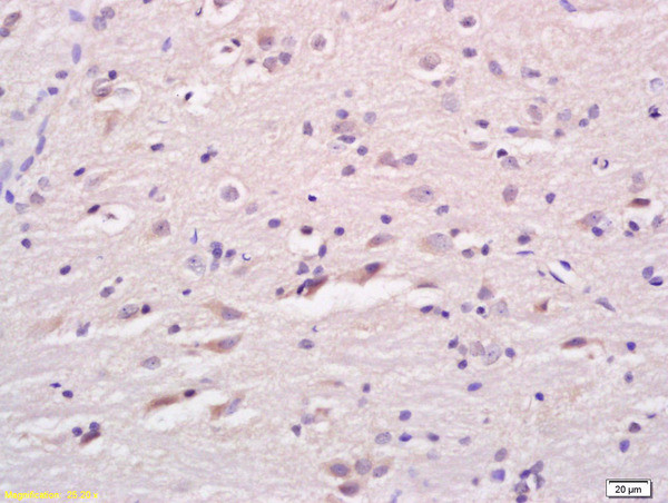 LCAT Antibody in Immunohistochemistry (Paraffin) (IHC (P))