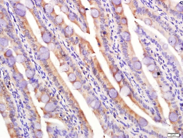 LPL Antibody in Immunohistochemistry (Paraffin) (IHC (P))