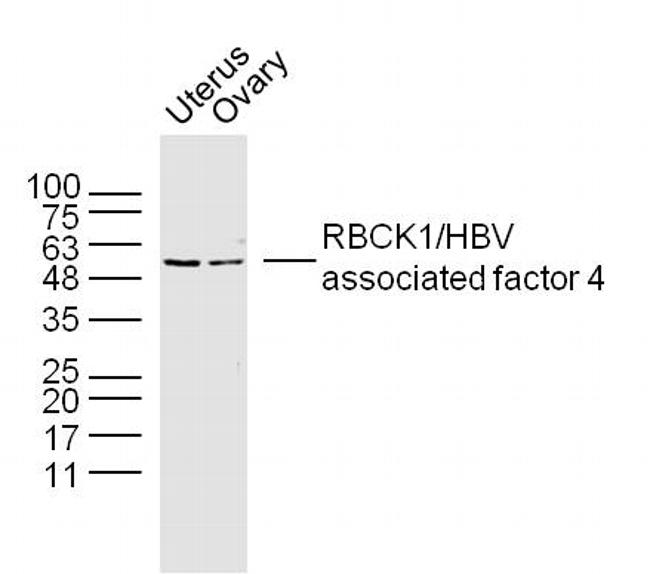 RBCK1 Antibody in Western Blot (WB)