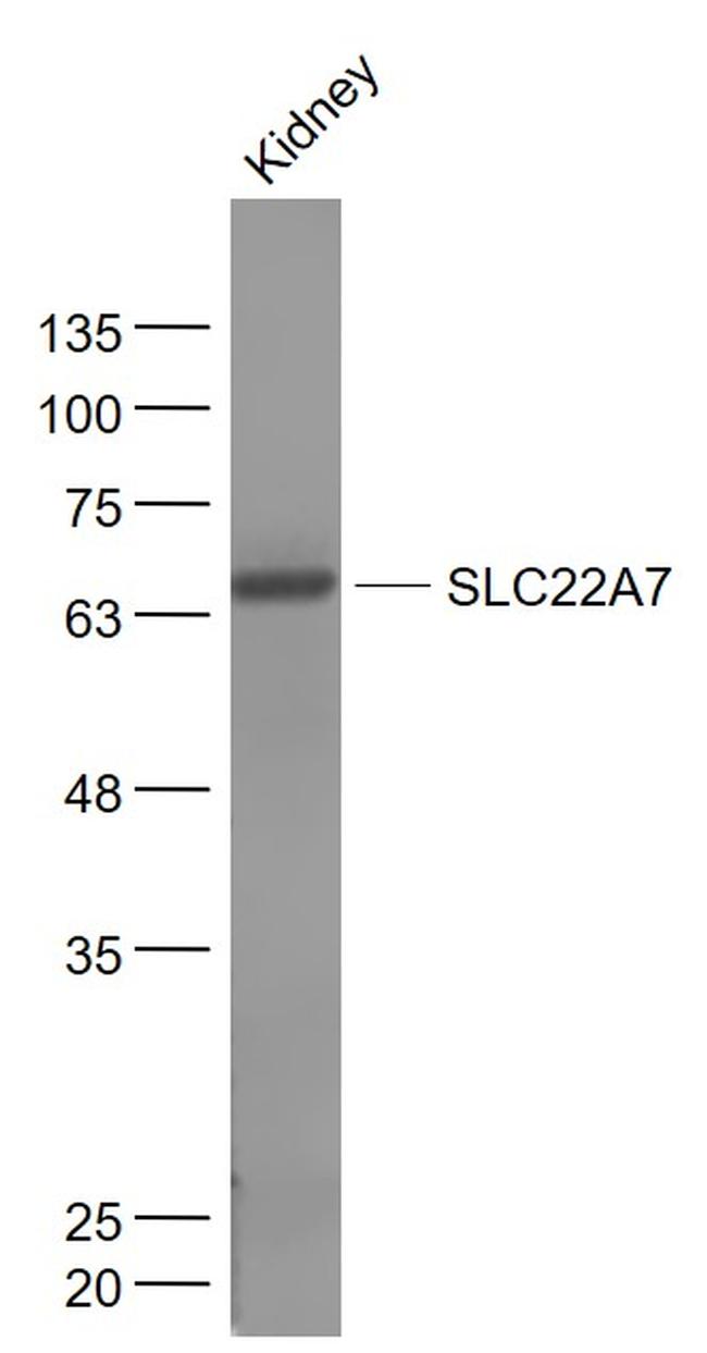 SLC22A7 Antibody in Western Blot (WB)