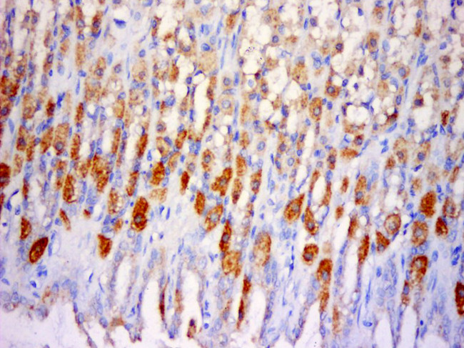 SLC25A38 Antibody in Immunohistochemistry (Paraffin) (IHC (P))