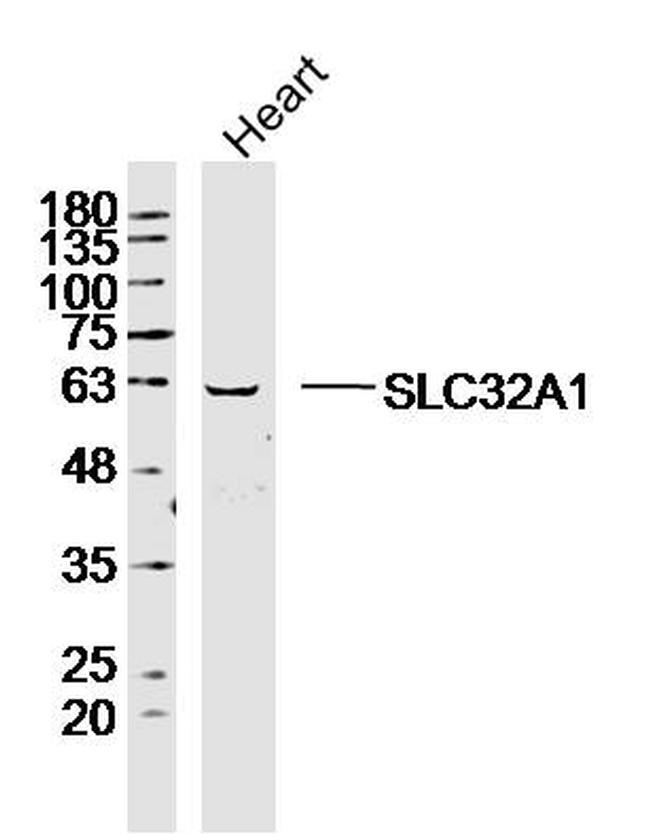 SLC32A1 Antibody in Western Blot (WB)