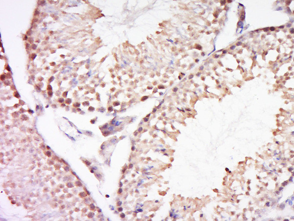 REV3L Antibody in Immunohistochemistry (Paraffin) (IHC (P))