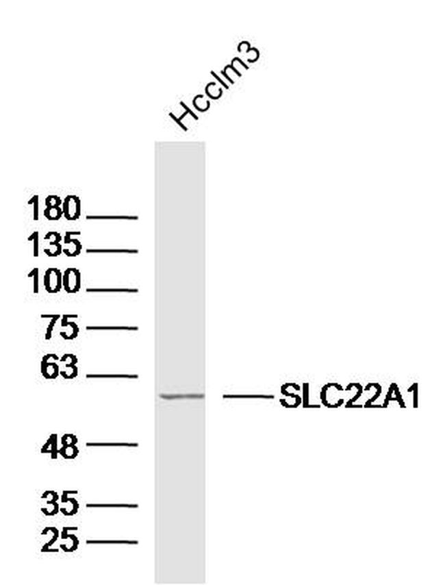 SLC22A1 Antibody in Western Blot (WB)