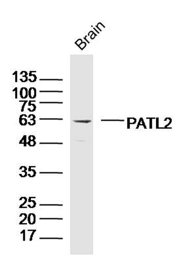 PATL2 Antibody in Western Blot (WB)