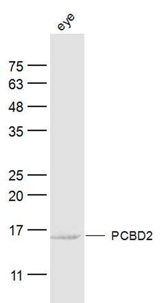 PCBD2 Antibody in Western Blot (WB)