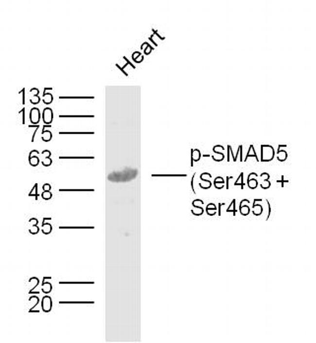 Phospho-SMAD5 (Ser463, Ser465) Antibody in Western Blot (WB)
