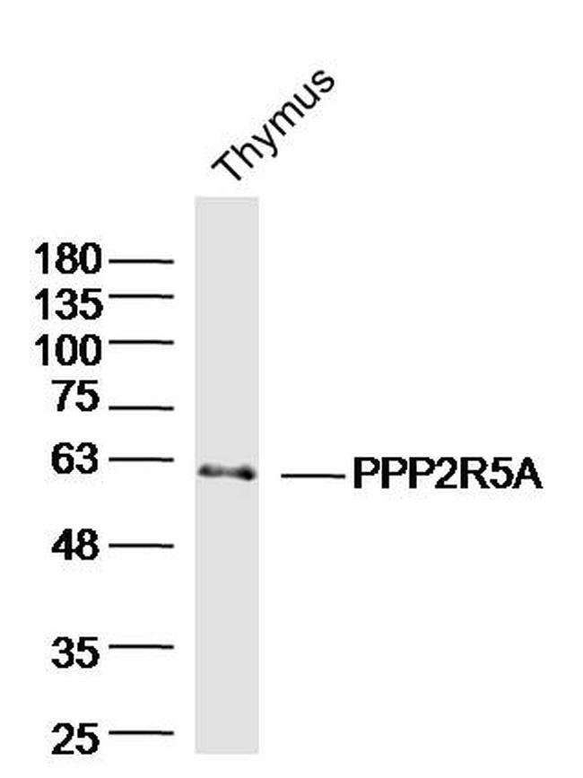 PPP2R5A Antibody in Western Blot (WB)