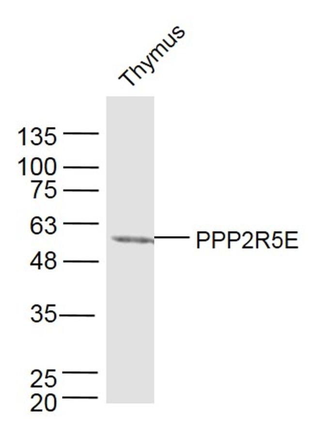 PPP2R5E Antibody in Western Blot (WB)