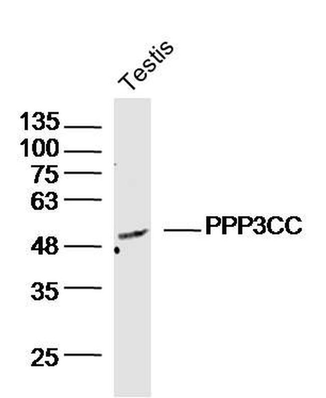 PPP3CC Antibody in Western Blot (WB)