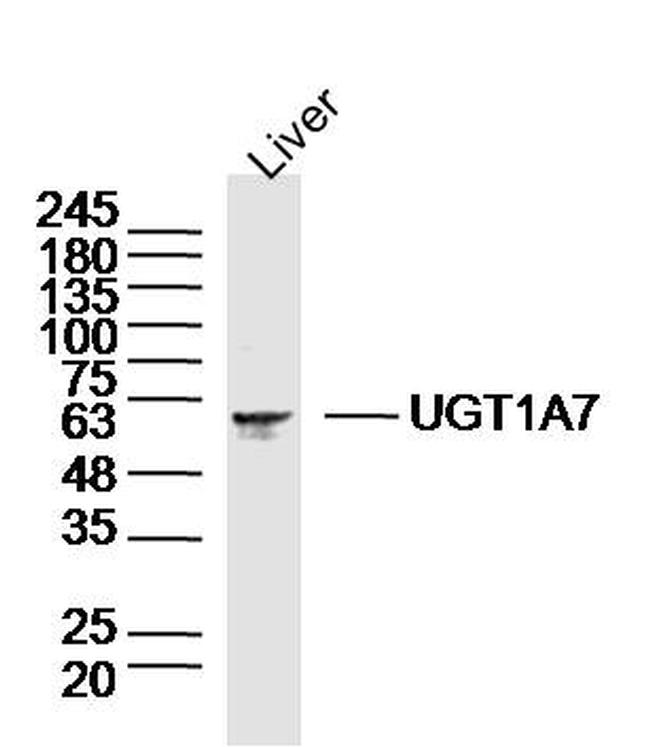 UGT1A7 Antibody in Western Blot (WB)