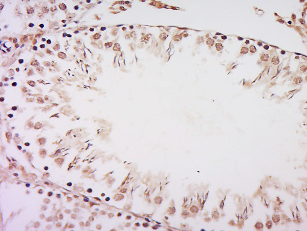 RanBP3 Antibody in Immunohistochemistry (Paraffin) (IHC (P))
