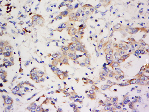 ZNF703 Antibody in Immunohistochemistry (Paraffin) (IHC (P))