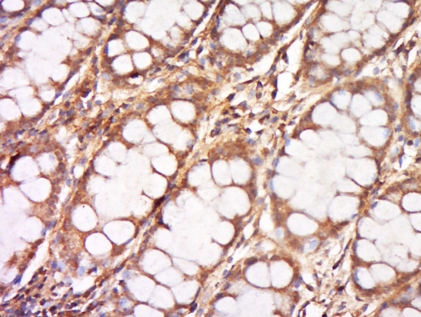 DNCLI1 Antibody in Immunohistochemistry (Paraffin) (IHC (P))