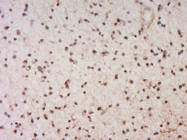 EYA1 Antibody in Immunohistochemistry (Paraffin) (IHC (P))