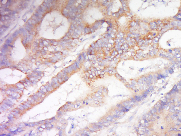 Phospho-AQP2 (Ser256) Antibody in Immunohistochemistry (Paraffin) (IHC (P))