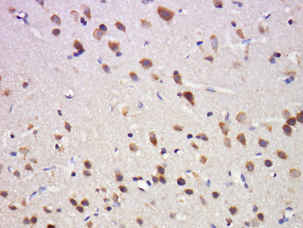 Phospho-OPRD1 (Ser363) Antibody in Immunohistochemistry (Paraffin) (IHC (P))