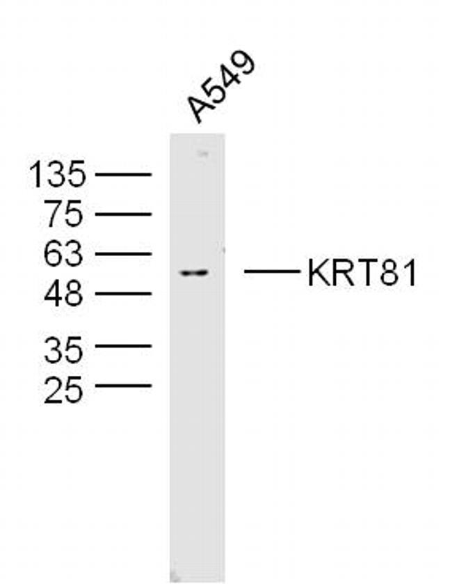 KRT81 Antibody in Western Blot (WB)