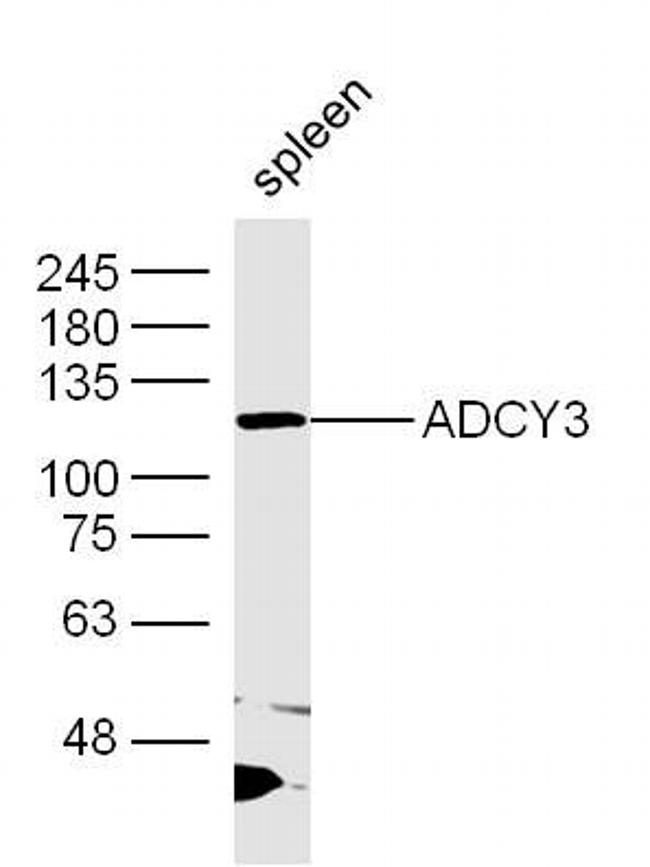 ADCY3 Antibody in Western Blot (WB)