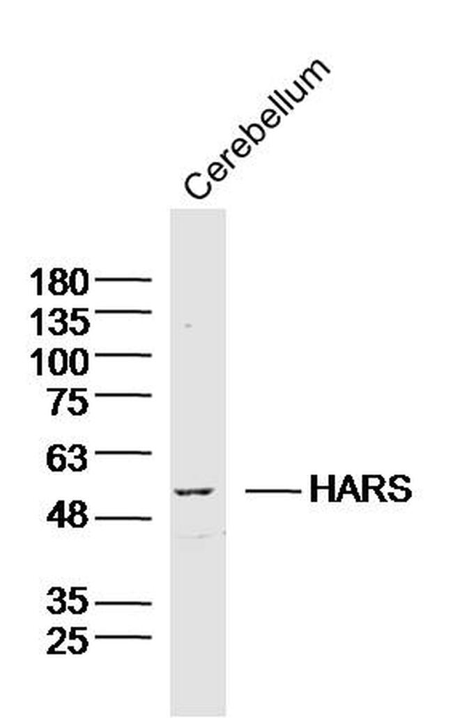 HARS Antibody in Western Blot (WB)