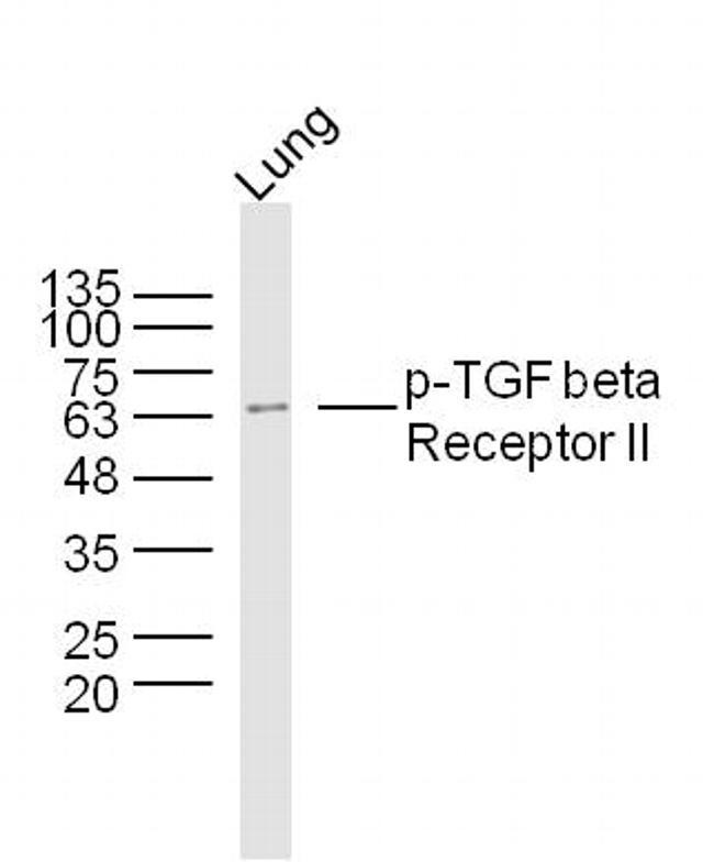 Phospho-TGF beta Receptor II (Ser225) Antibody in Western Blot (WB)