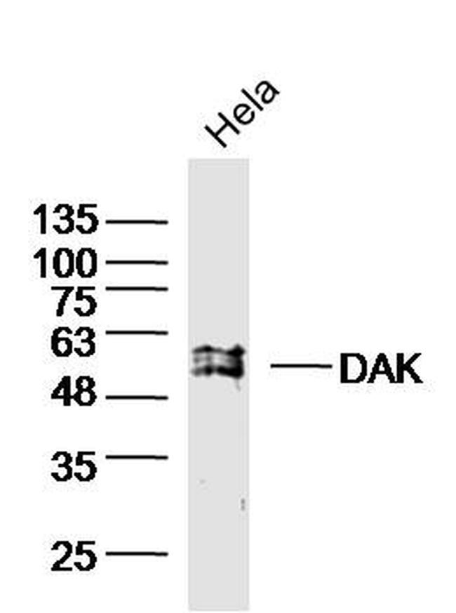DAK Antibody in Western Blot (WB)