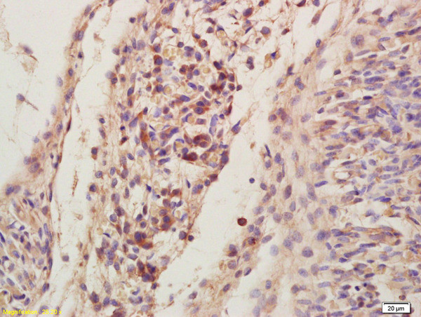 LIS1 Antibody in Immunohistochemistry (Paraffin) (IHC (P))