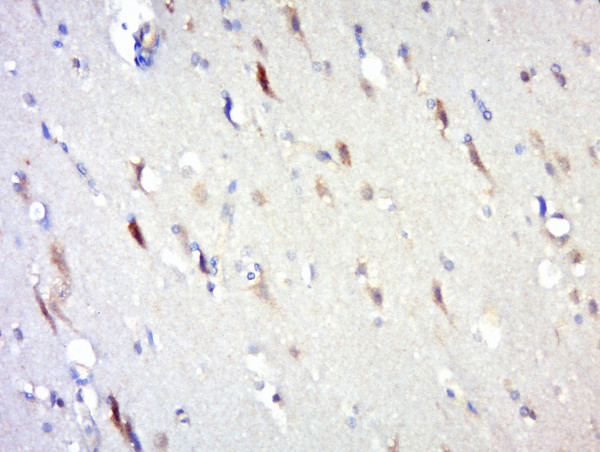 IL-10 Antibody in Immunohistochemistry (Paraffin) (IHC (P))