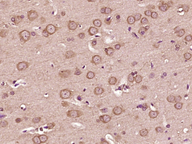 VEGFA Antibody in Immunohistochemistry (Paraffin) (IHC (P))