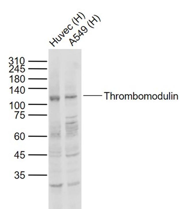 Thrombomodulin Antibody in Western Blot (WB)