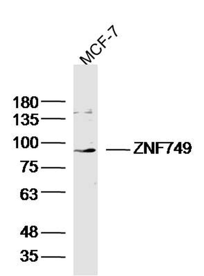 ZNF749 Antibody in Western Blot (WB)