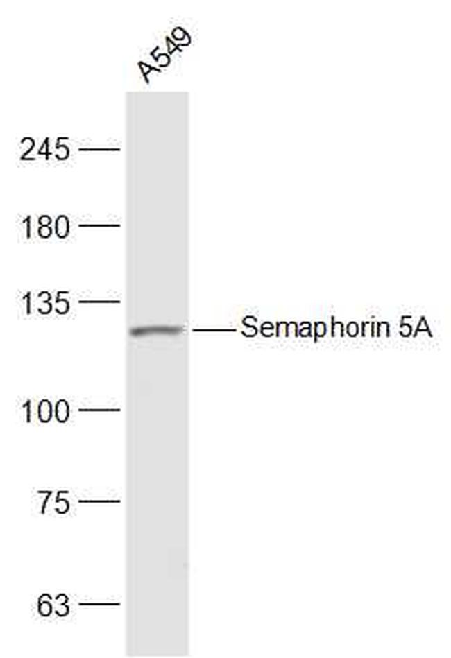 Semaphorin 5A Antibody in Western Blot (WB)